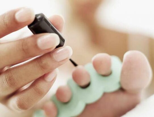 köröm kezelése körömlakkkal gombás fertőzés esetén