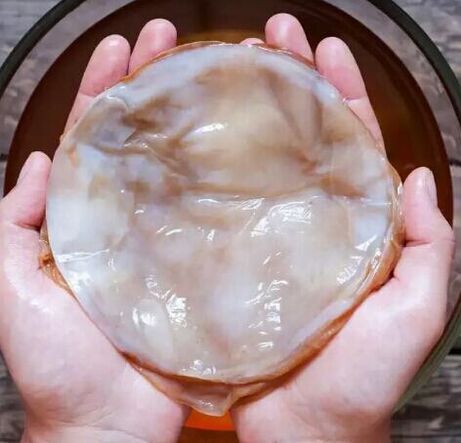 köröm gomba kombucha